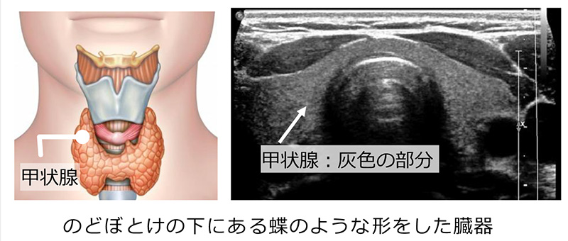 正常な甲状腺の構造とエコー画像