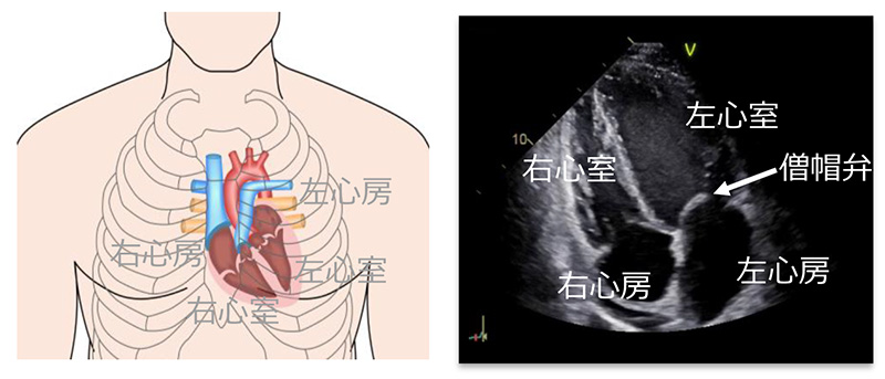 正常な心臓の構造とエコー画像