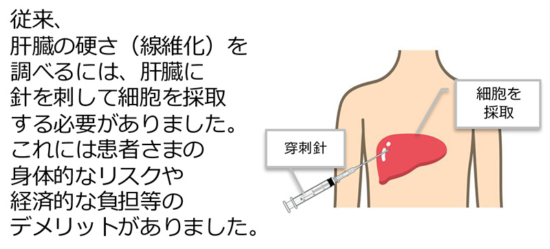 従来の肝線維化診断