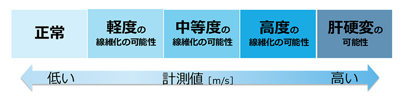 肝硬度測定