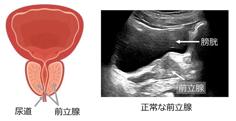 正常な前立腺の模式図とエコー画像